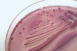 Escherichia coli idrardan nereye gidiyor?